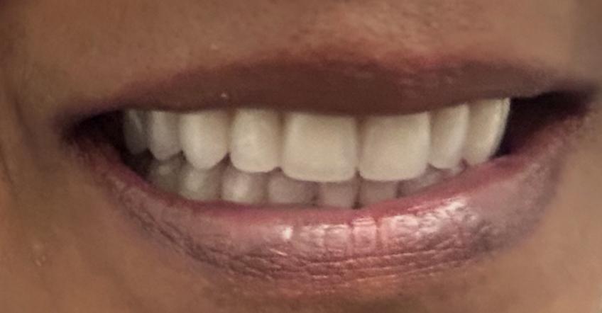 smileandshinedentureclinic