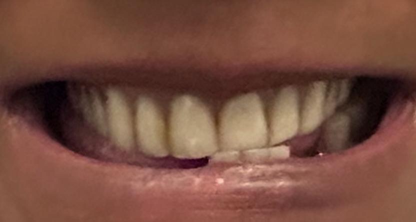 smileandshinedentureclinic