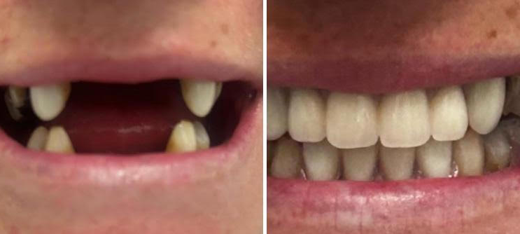 smileandshinedentureclinic