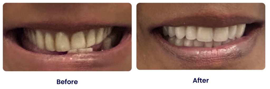 smileandshinedentureclinic