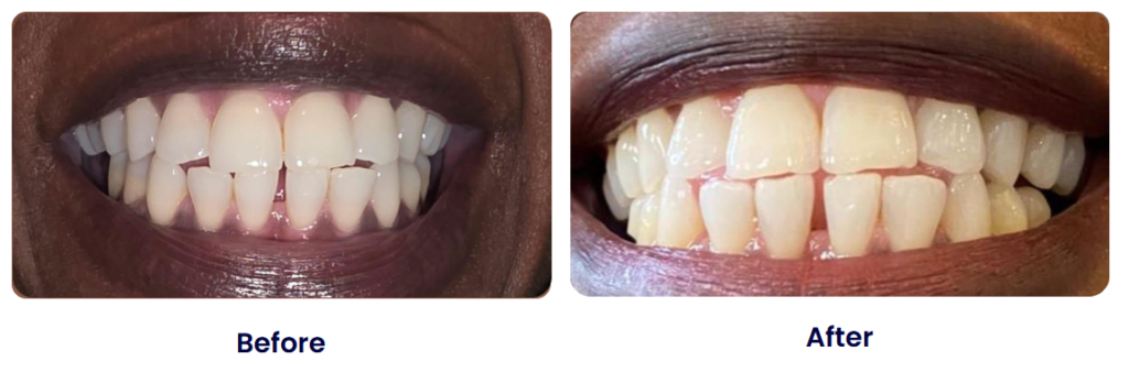 smileandshinedentureclinic